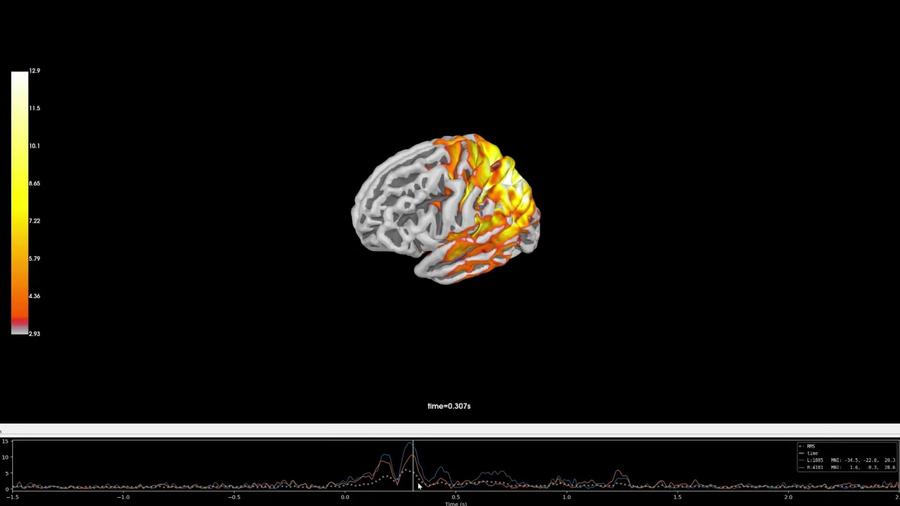 Inside the Virtual Brain: Wie unser Gehirn auf Reize reagiert